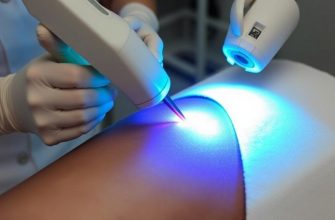 Лазерная эпиляция: что это, как работает и чего на самом деле ждать